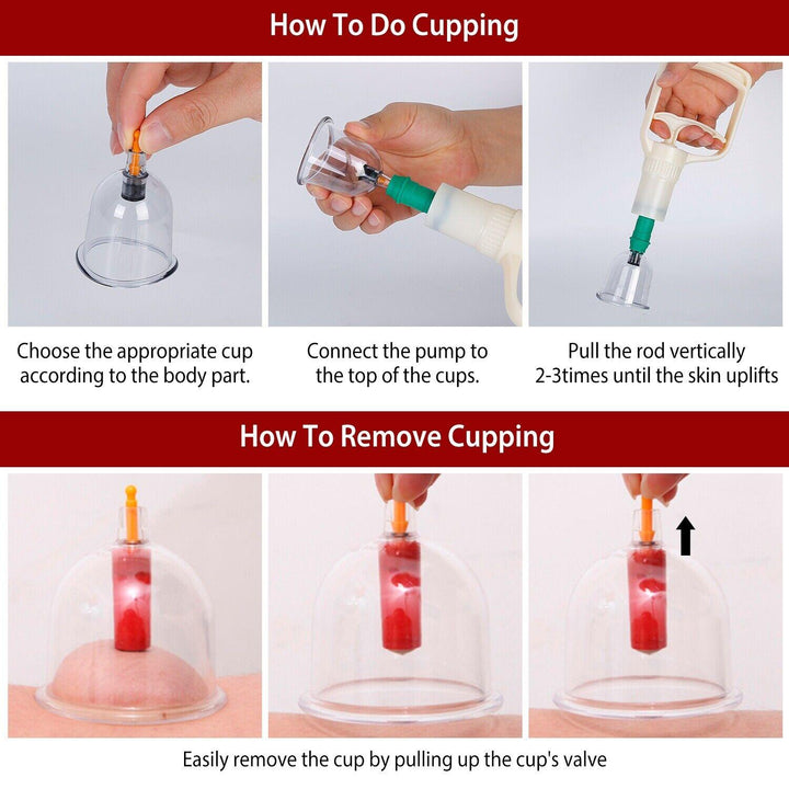 Cupping Therapy Set - 32PCS Cupping Vacuum Massage Cups Set Therapy Health Acupuncture Suction Magnet 4