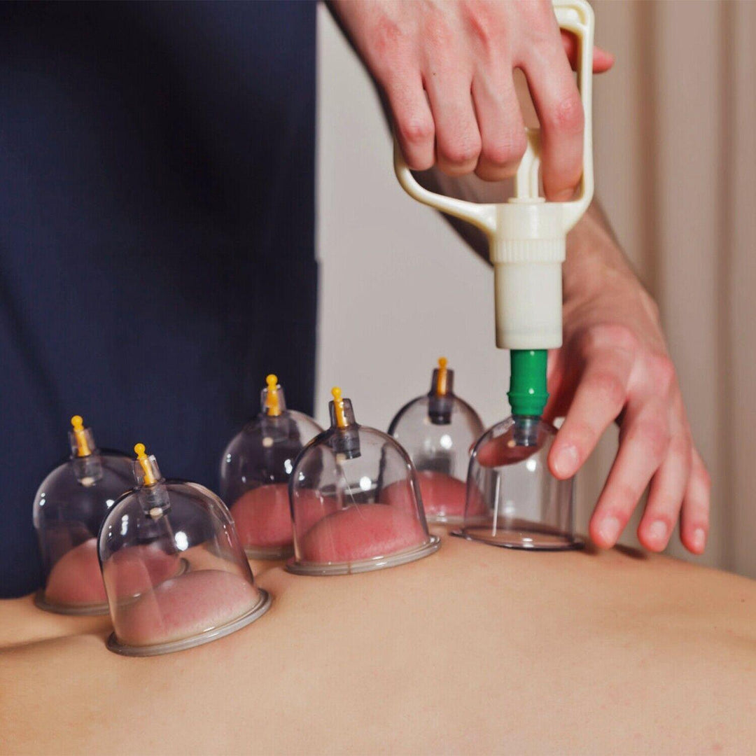 Cupping Therapy Set - 32PCS Cupping Vacuum Massage Cups Set Therapy Health Acupuncture Suction Magnet 7