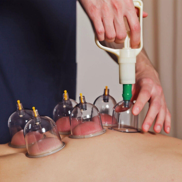 Cupping Therapy Set - 32PCS Cupping Vacuum Massage Cups Set Therapy Health Acupuncture Suction Magnet 7