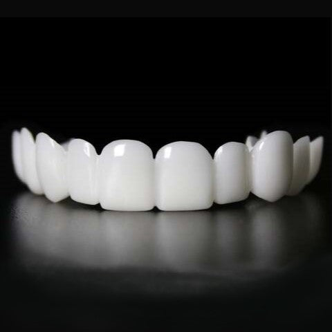Instant smile transformation with Snap on Smile veneers 2