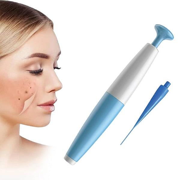 Skin Tag Removal Kit - Natural Painless Auto SKIN TAG Removal Skin tag bands Remover Device 0